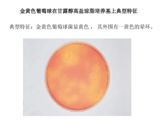 金黄色葡萄球菌培养状态
