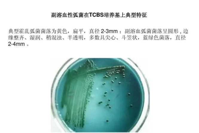 副溶血性弧菌培养状态